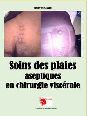 cover image of Soins Des Plaies Aseptiques En Chirurgie Viscérale